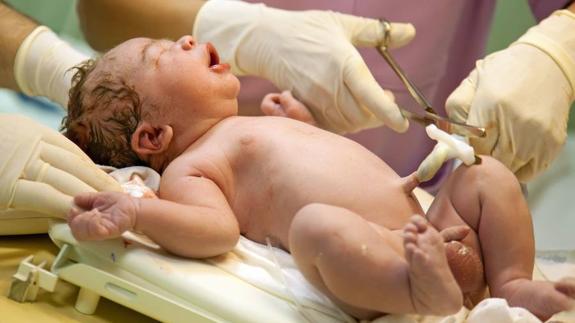 imagen de arteria umbilical unica